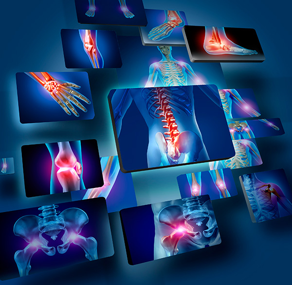 Clínica Ortopédica- O Que é e Quando Procurar ortopedistas de lesoes